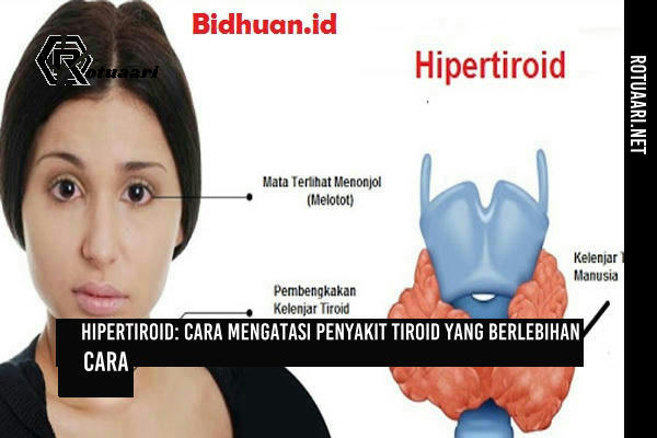 hipertiroid cara mengatasi